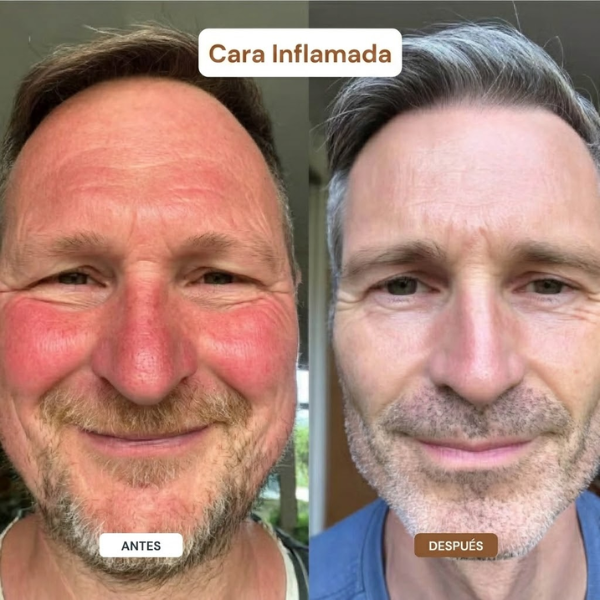 Complejo de Órganos de Res Nevoo