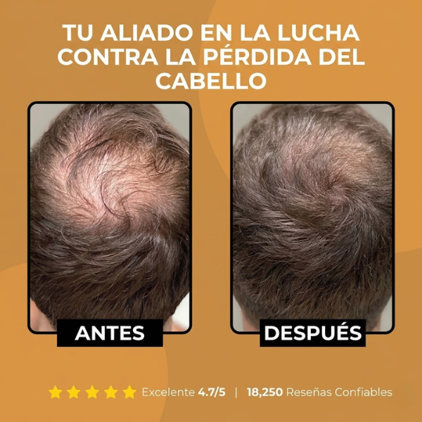 Shampoo Activador de Raíz Nevoo
