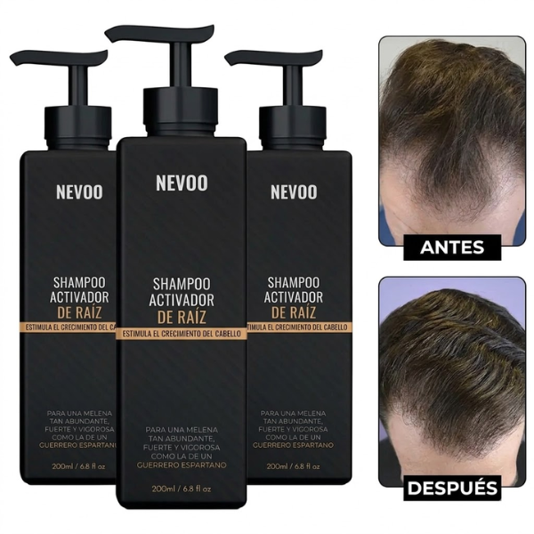 Shampoo Activador de Raíz Nevoo